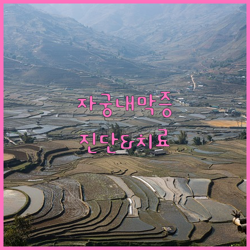 난임의 고통, 자궁내막증 진단과 치료의 모든 것